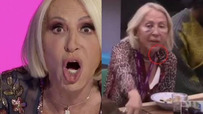 La 'Casa de Los Famosos': Laura Bozzo preocupada por su salud, ya perdió cuatro dientes