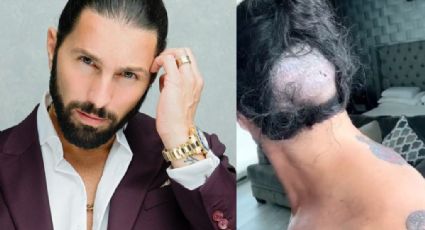 El Covid-19 dejó pelón a Poncho de Nigris y tuvo que someterse a un tratamiento